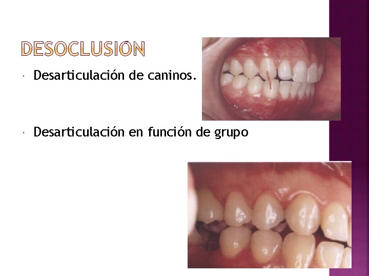  Desarticulación de caninos. Desarticulación en función de grupo 
