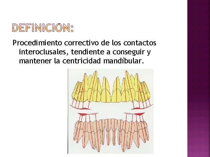 Procedimiento correctivo de los contactos interoclusales, tendiente a conseguir y mantener la centricidad mandíbular.