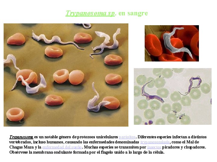 Trypanosoma sp. en sangre Trypanosoma es un notable género de protozoos unicelulares parásitos. Diferentes