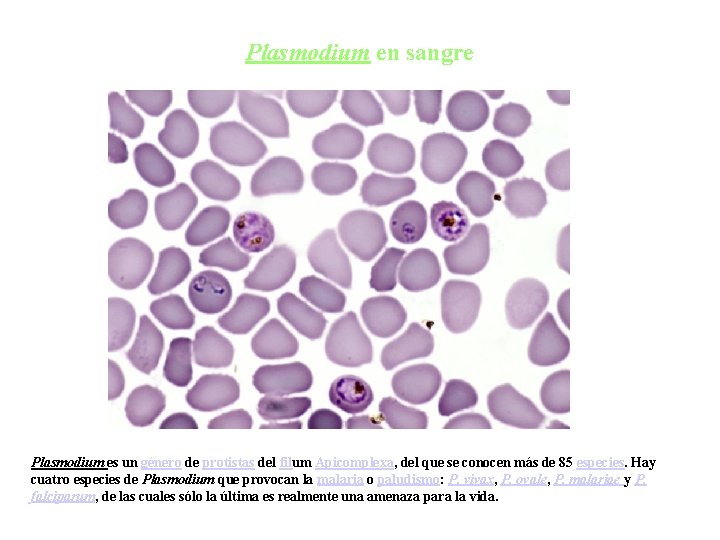 Plasmodium en sangre Plasmodium es un género de protistas del filum Apicomplexa, del que