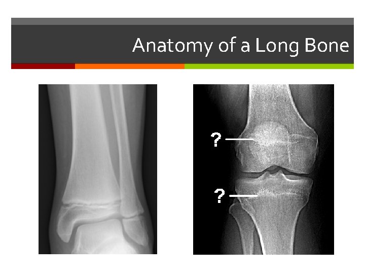 Anatomy of a Long Bone 