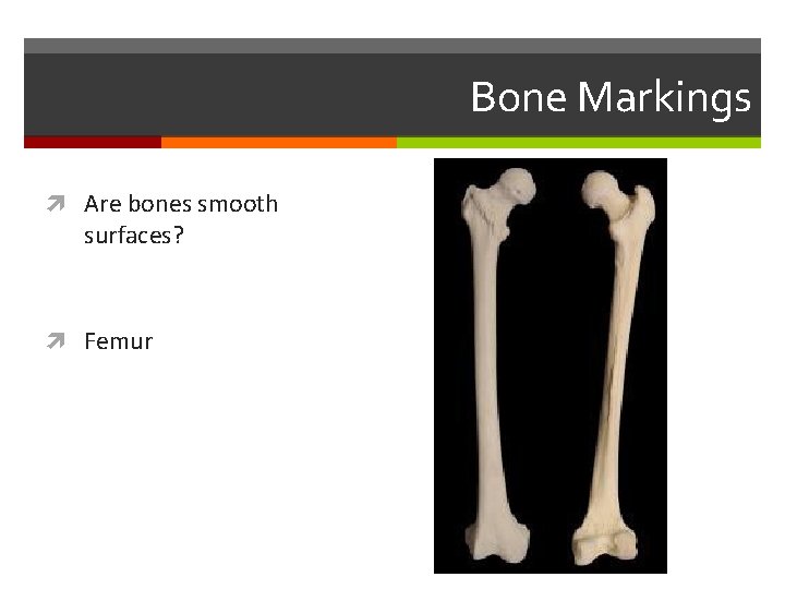 Bone Markings Are bones smooth surfaces? Femur Bone Markings Are bones smooth surfaces? Femur