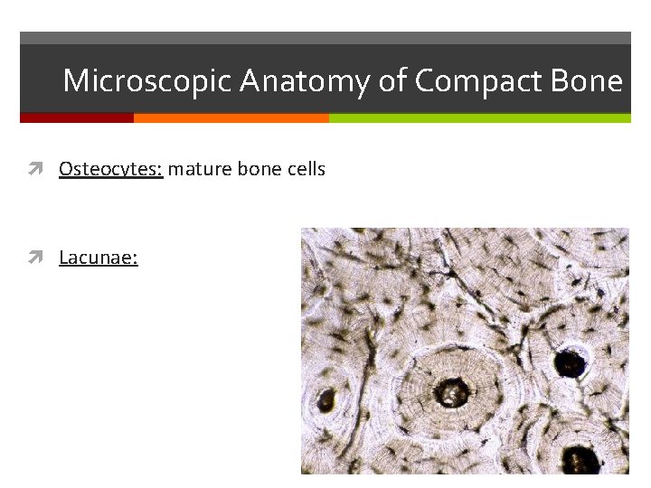 Microscopic Anatomy of Compact Bone Osteocytes: mature bone cells Lacunae: Microscopic Anatomy of Compact Bone Osteocytes: mature bone cells Lacunae: