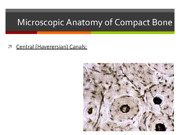Microscopic Anatomy of Compact Bone Central (Haverersian) Canals: Microscopic Anatomy of Compact Bone Central (Haverersian) Canals: