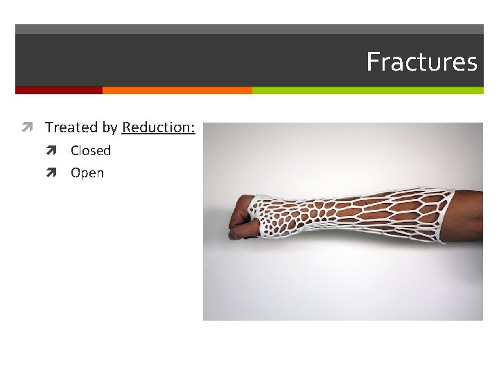 Fractures Treated by Reduction: Closed Open Fractures Treated by Reduction: Closed Open