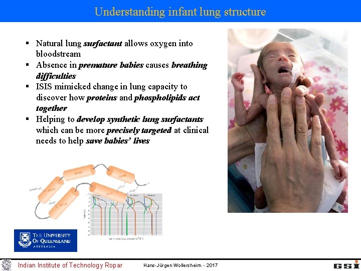 Understanding infant lung structure § Natural lung surfactant allows oxygen into bloodstream § Absence