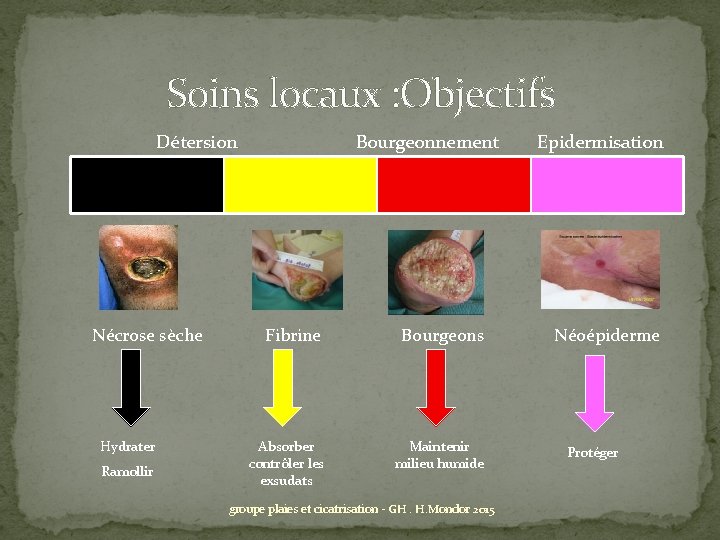 Soins locaux : Objectifs Détersion Bourgeonnement Epidermisation Nécrose sèche Hydrater Ramollir Fibrine Absorber contrôler