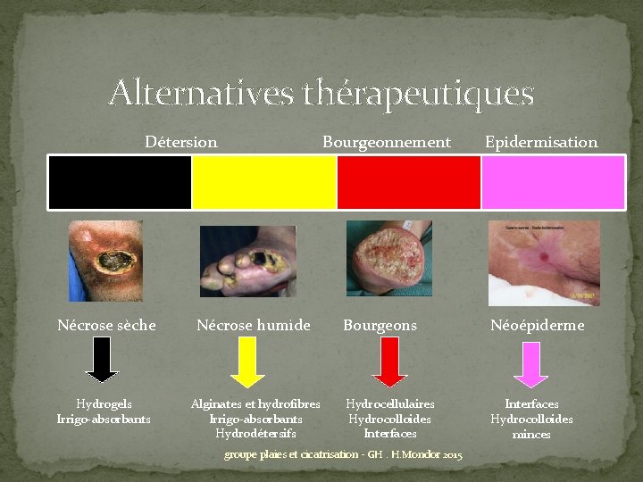 Alternatives thérapeutiques Détersion Bourgeonnement Epidermisation Nécrose sèche Nécrose humide Hydrogels Irrigo-absorbants Alginates et hydrofibres