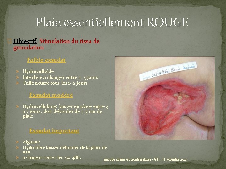 Plaie essentiellement ROUGE � Objectif: Stimulation du tissu de granulation Faible exsudat Ø Hydrocolloide