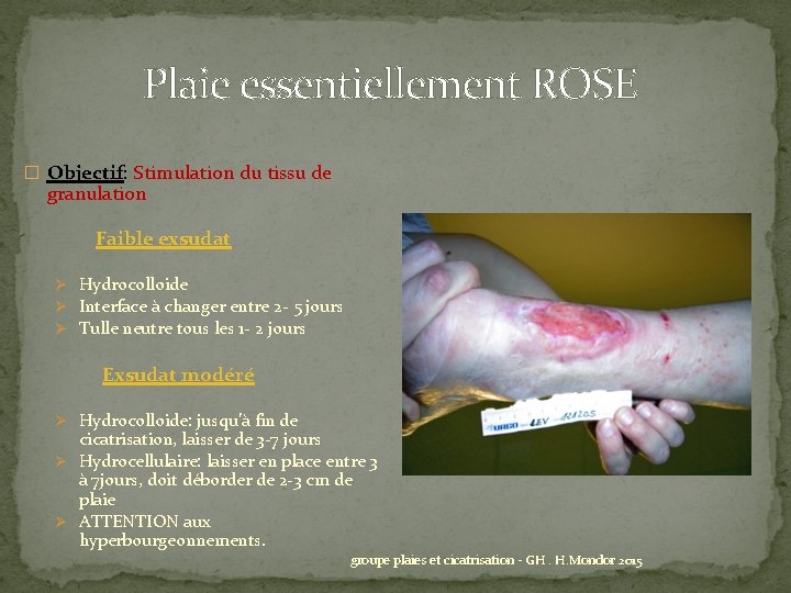 Plaie essentiellement ROSE � Objectif: Stimulation du tissu de granulation Faible exsudat Ø Hydrocolloide