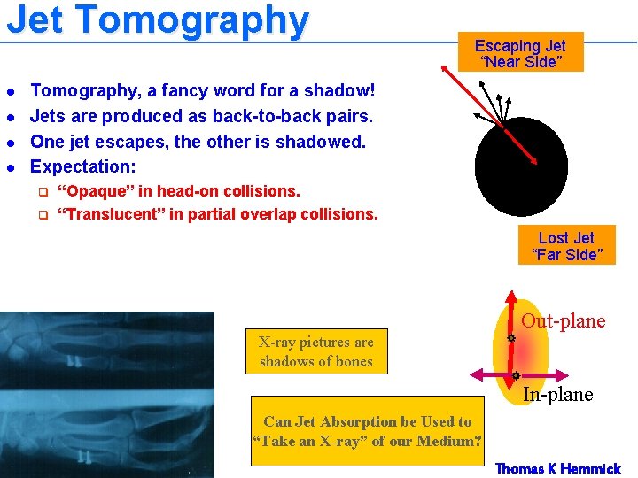 Jet Tomography l l Escaping Jet “Near Side” Tomography, a fancy word for a Jet Tomography l l Escaping Jet “Near Side” Tomography, a fancy word for a