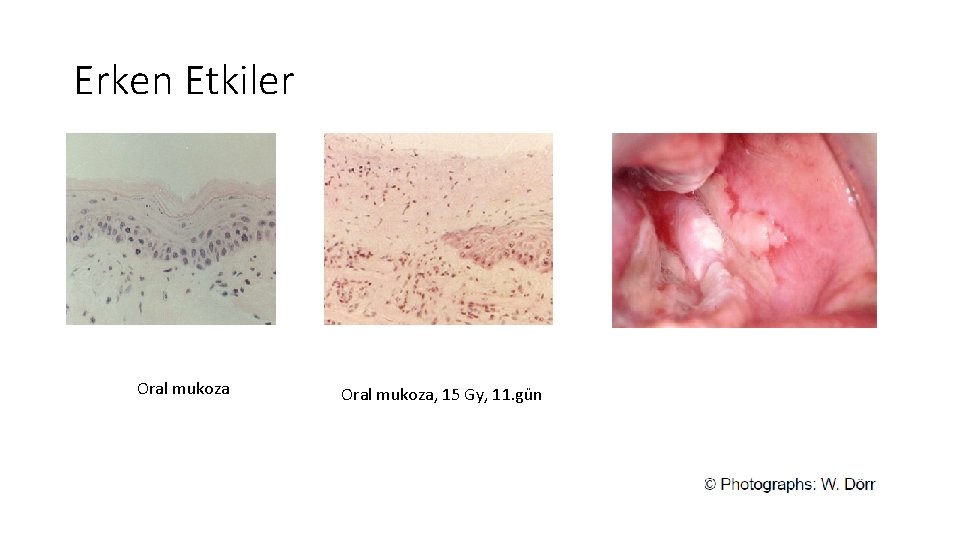 Erken Etkiler Oral mukoza, 15 Gy, 11. gün Erken Etkiler Oral mukoza, 15 Gy, 11. gün