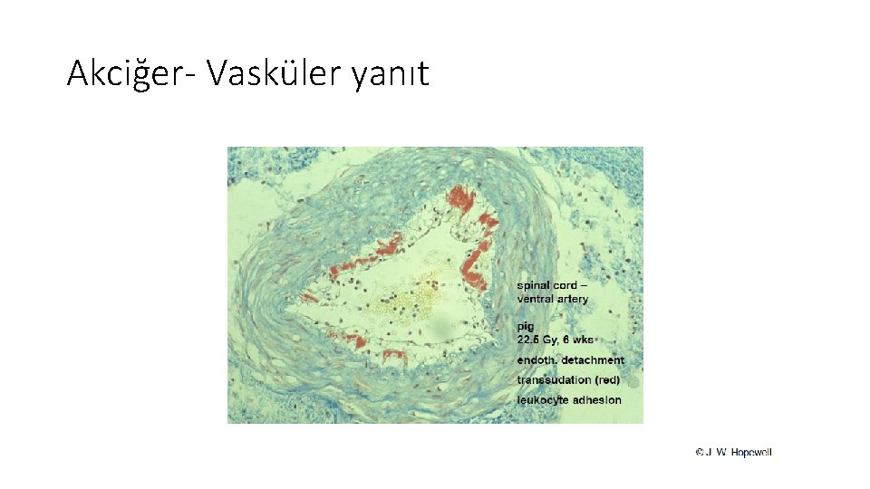 Akciğer- Vasküler yanıt Akciğer- Vasküler yanıt