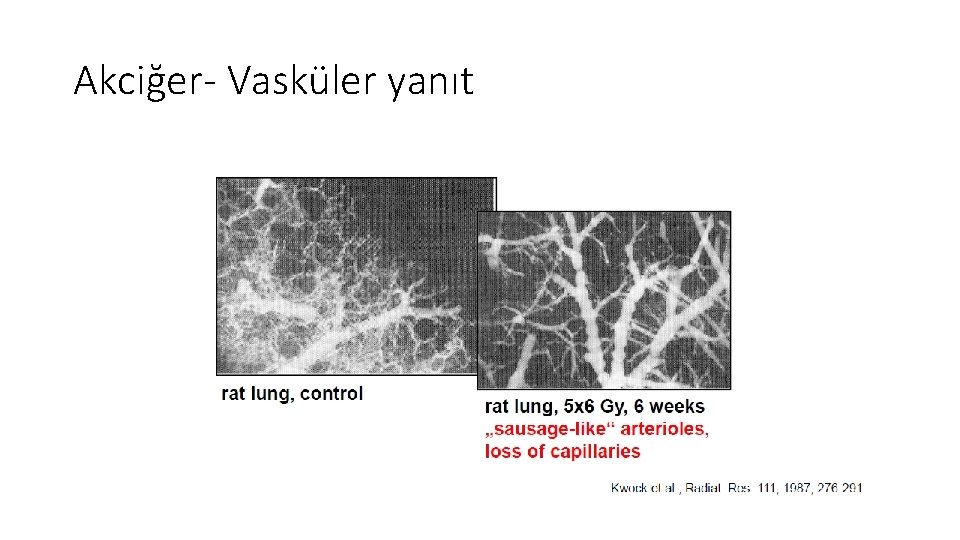 Akciğer- Vasküler yanıt Akciğer- Vasküler yanıt