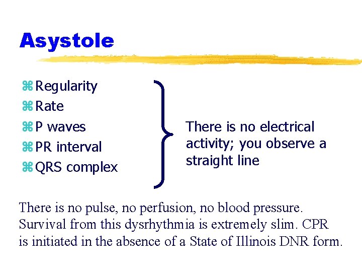 Asystole z Regularity z Rate z P waves z PR interval z QRS complex