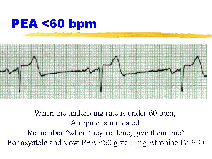 PEA <60 bpm When the underlying rate is under 60 bpm, Atropine is indicated.