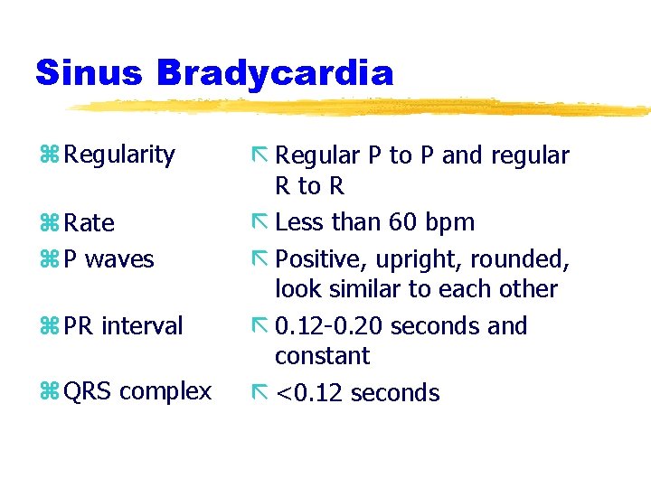 Sinus Bradycardia z Regularity z Rate z P waves z PR interval z QRS