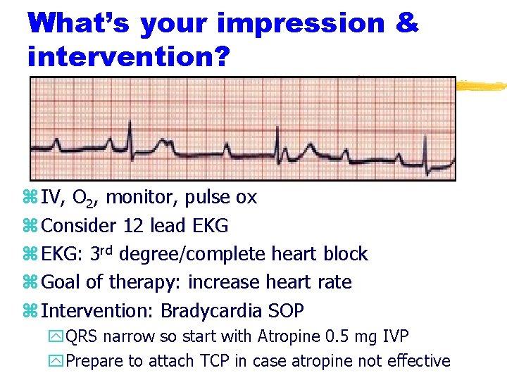 What’s your impression & intervention? z IV, O 2, monitor, pulse ox z Consider