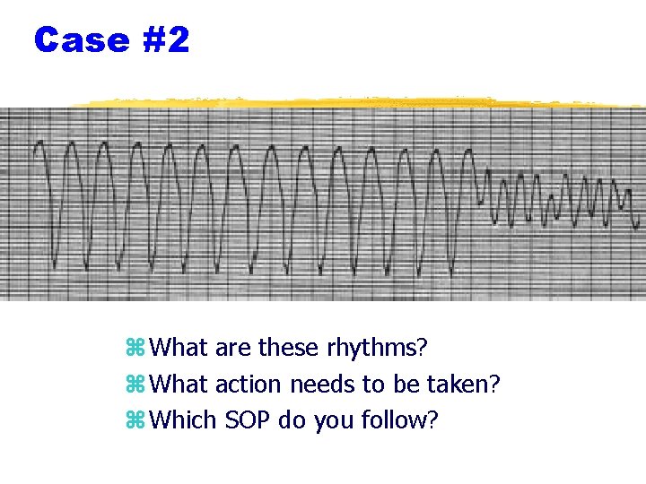 Case #2 z What are these rhythms? z What action needs to be taken?