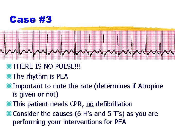 Case #3 z THERE IS NO PULSE!!! z The rhythm is PEA z Important