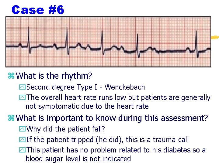 Case #6 z What is the rhythm? y. Second degree Type I - Wenckebach