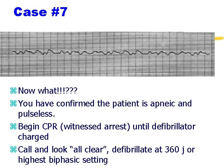 Case #7 z Now what!!!? ? ? z You have confirmed the patient is