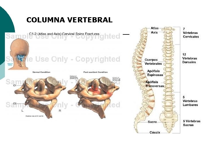 COLUMNA VERTEBRAL 