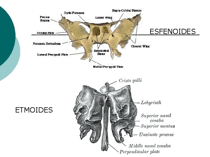 ESFENOIDES ETMOIDES 