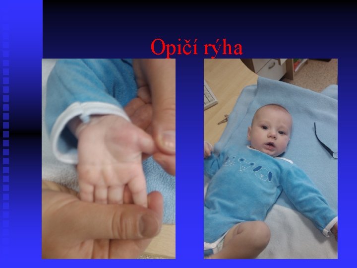 Opičí rýha 