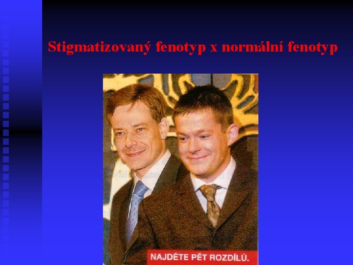 Stigmatizovaný fenotyp x normální fenotyp 