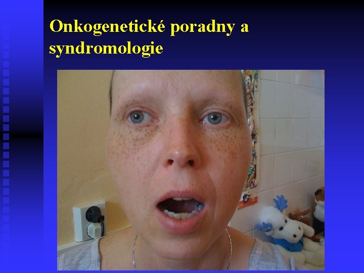 Onkogenetické poradny a syndromologie 