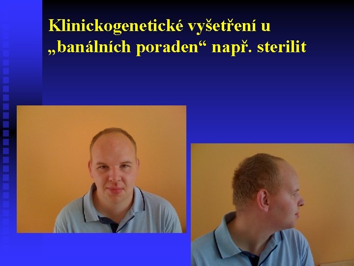 Klinickogenetické vyšetření u „banálních poraden“ např. sterilit 