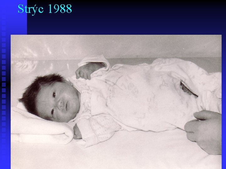 Strýc 1988 