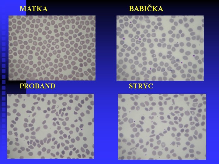 MATKA BABIČKA PROBAND STRÝC 