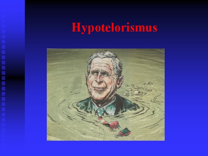 Hypotelorismus 