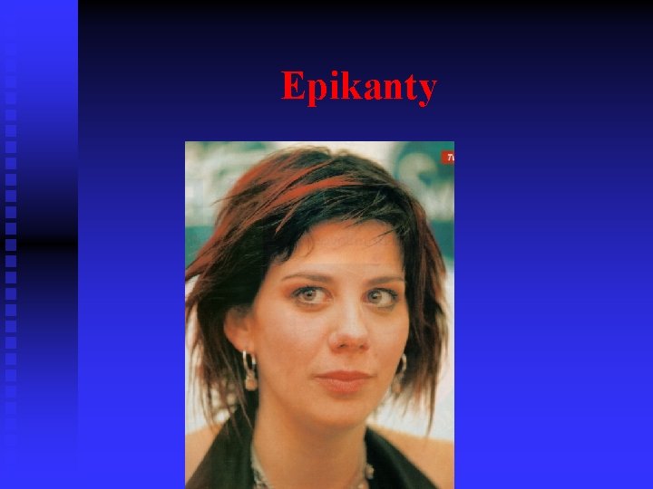 Epikanty 