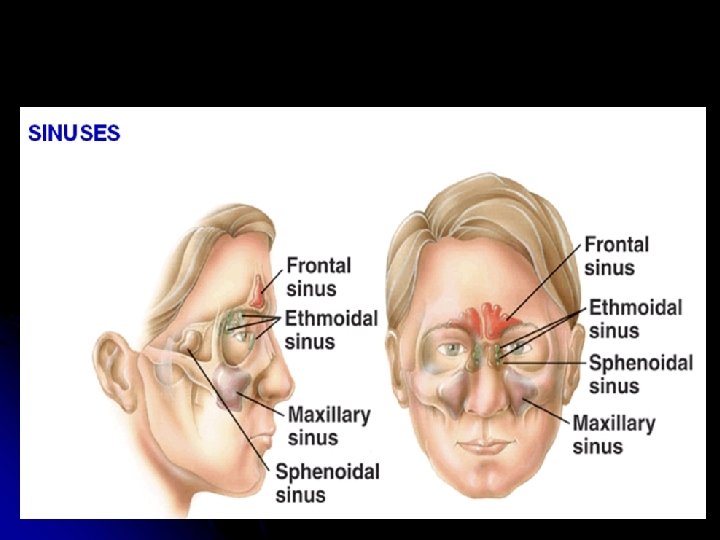 Headache Facial Pain Headache L 3 Main Headache