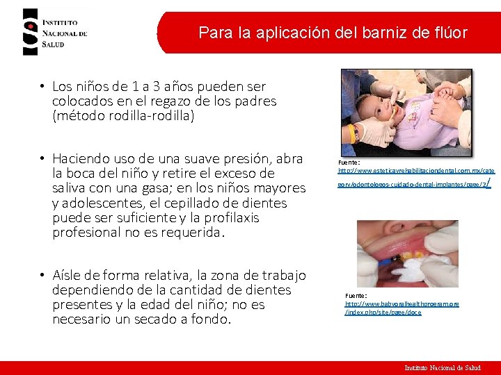Para la aplicación del barniz de flúor • Los niños de 1 a 3 Para la aplicación del barniz de flúor • Los niños de 1 a 3