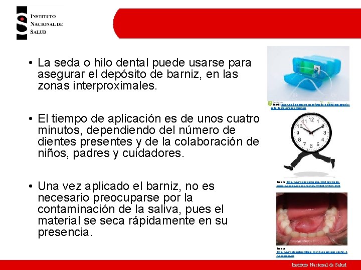  • La seda o hilo dental puede usarse para asegurar el depósito de