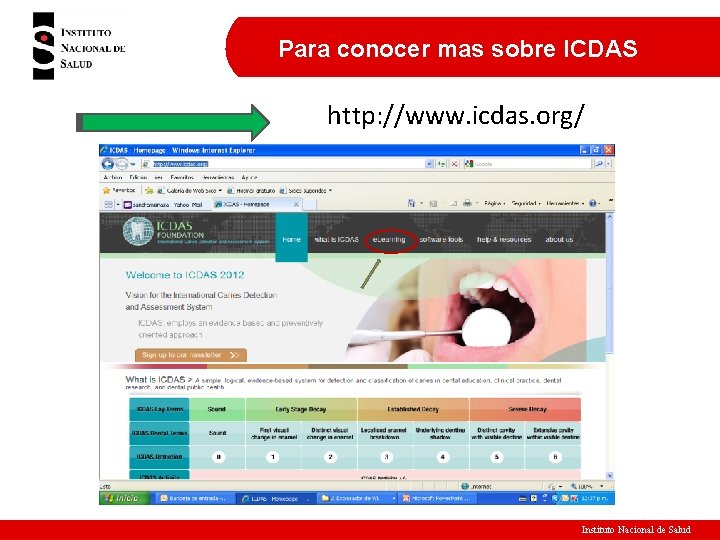 Para conocer mas sobre ICDAS http: //www. icdas. org/ Instituto Nacional de Salud 