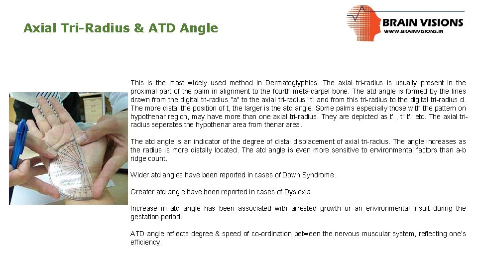 Axial Tri-Radius & ATD Angle This is the most widely used method in Dermatoglyphics.