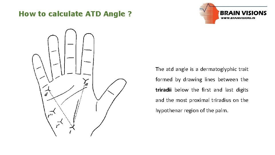 How to calculate ATD Angle ? The atd angle is a dermatoglyphic trait formed