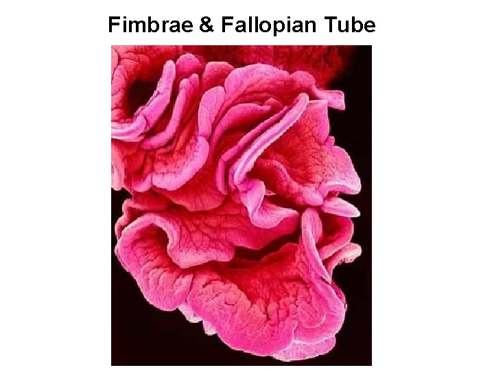 Fimbrae & Fallopian Tube 