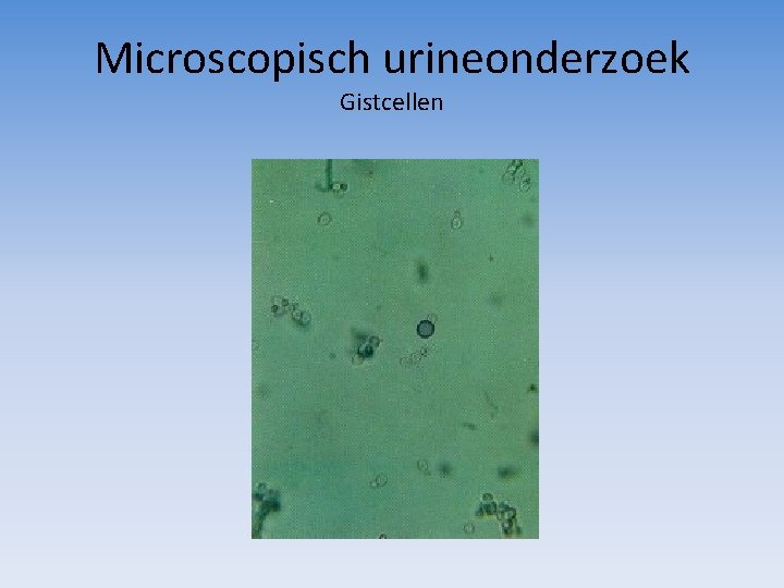 Microscopisch urineonderzoek Gistcellen 