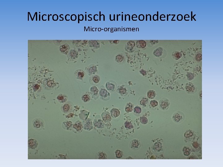 Microscopisch urineonderzoek Micro-organismen 