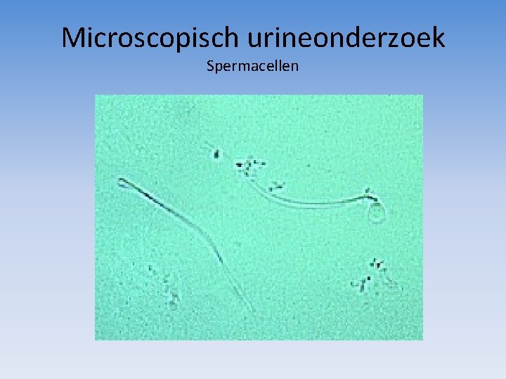 Microscopisch urineonderzoek Spermacellen 