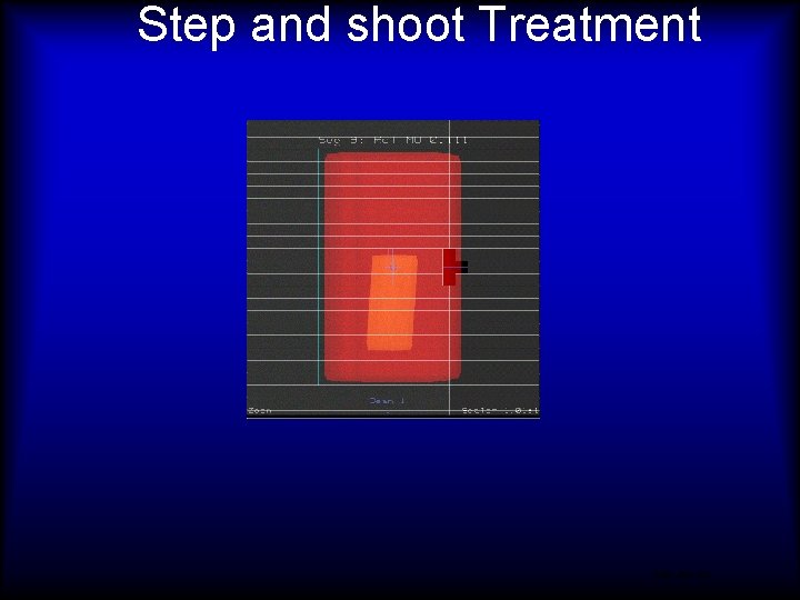 Step and shoot Treatment 9991 -959 -10 A 