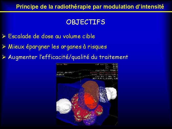 Principe de la radiothérapie par modulation d’intensité OBJECTIFS Ø Escalade de dose au volume