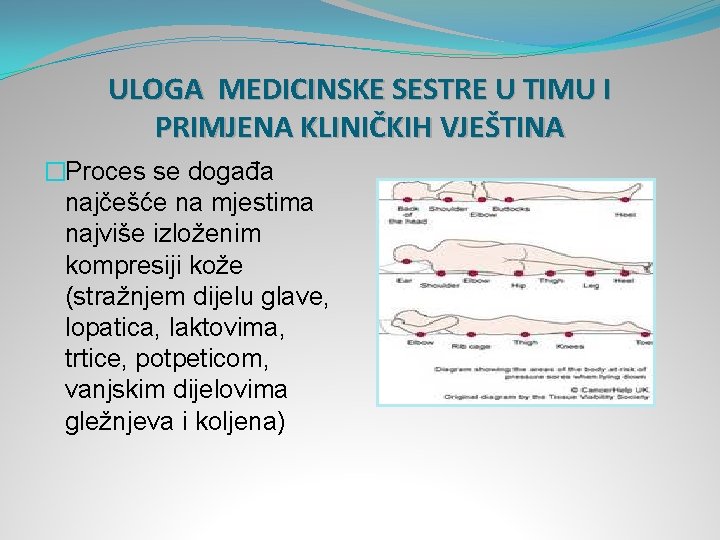 ULOGA MEDICINSKE SESTRE U TIMU I PRIMJENA KLINIČKIH VJEŠTINA �Proces se događa najčešće na