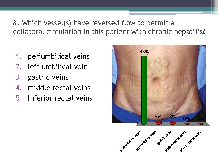 8. Which vessel(s) have reversed flow to permit a collateral circulation in this patient 8. Which vessel(s) have reversed flow to permit a collateral circulation in this patient